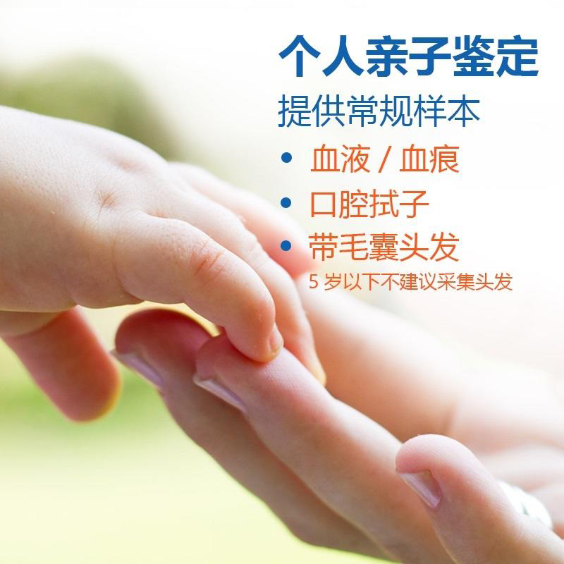宜宾毛发能做DNA鉴定吗,隐私亲子鉴定办理流程 宜宾毛发能做DNA鉴定吗,隐私亲子鉴定办理流程