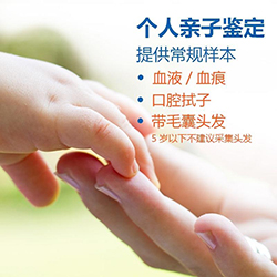 宜宾毛发能做DNA鉴定吗，隐私亲子鉴定办理流程