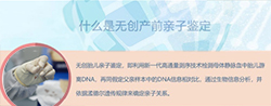 宜宾产前亲子鉴定中心出结果要多久，宜宾孕期亲子鉴定需要什么材料和流程