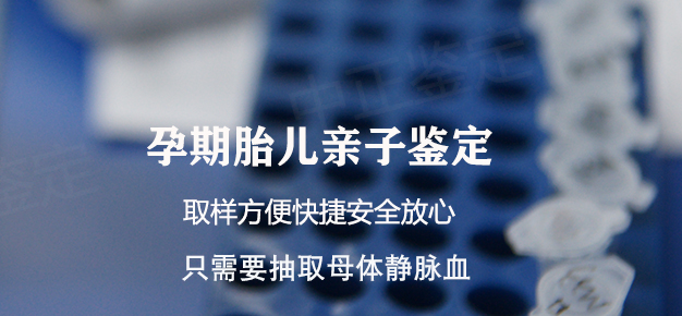 宜宾胎儿怎么样偷偷做DNA亲子鉴定,宜宾产前亲子鉴定哪里做的准 宜宾胎儿怎么样偷偷做DNA亲子鉴定,宜宾产前亲子鉴定哪里做的准