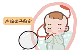 宜宾产前亲子鉴定详细流程（电话咨询）