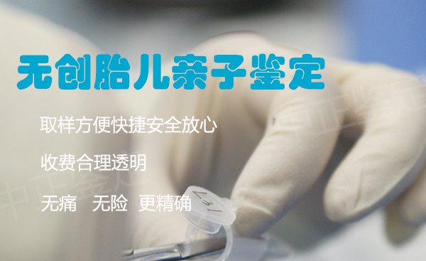怀孕期间宜宾需要怎么做产前亲子鉴定,宜宾做怀孕亲子鉴定结果到底准不准确 怀孕期间宜宾需要怎么做产前亲子鉴定,宜宾做怀孕亲子鉴定结果到底准不准确